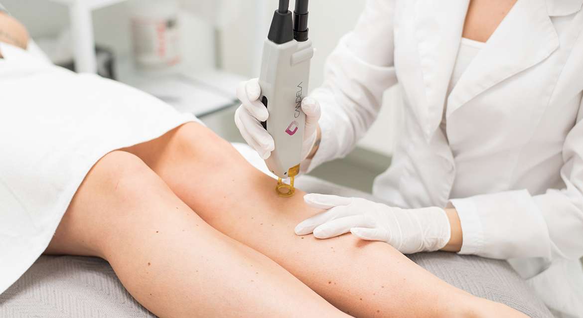 Laser αποτρίχωσης Αλεξανδρίτη: όλα όσα θέλετε να μάθετε